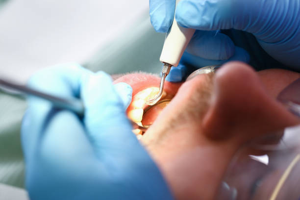 Best Emergency Treatment for Jaw Pain or Injury in Urbana, OH